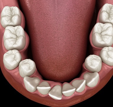 Toothbrush with paste