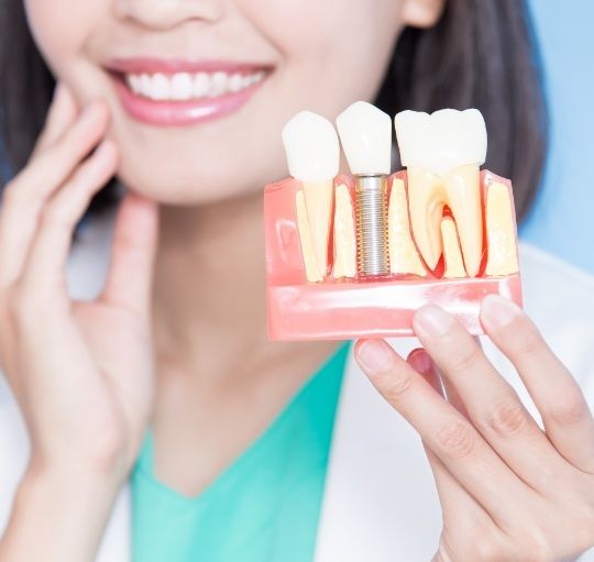 Dentist holding a model of a dental implant in the jaw