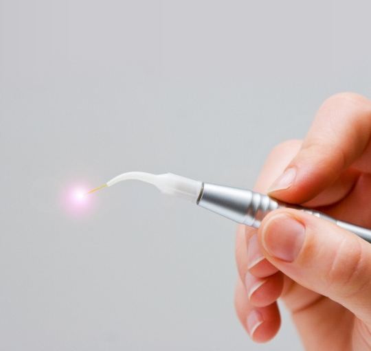 Hand holding a soft tissue laser device