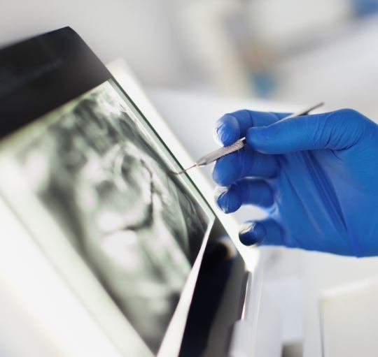 Dentist looking at digital x rays of teeth