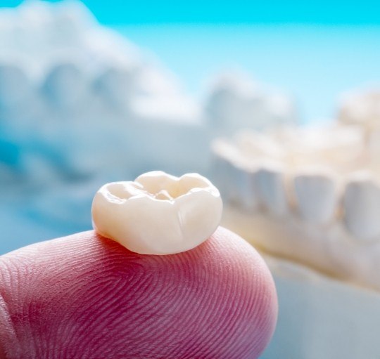 Dental crown resting on a finger